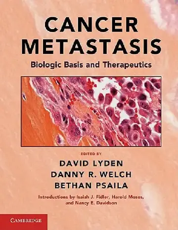 Cover of Cancer Metastasis