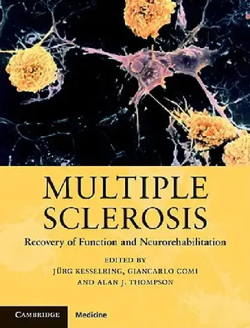 Cover of Multiple Sclerosis