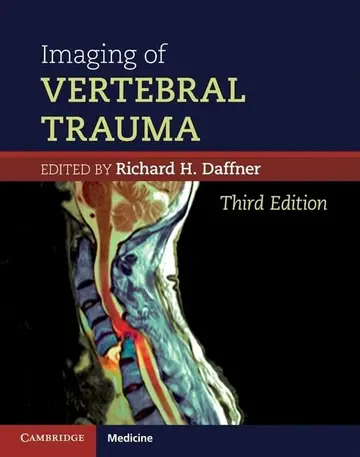 Cover of Imaging of Vertebral Trauma
