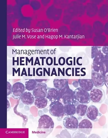 Cover of Management of Hematologic Malignancies