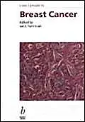 Cover of Challenges in Breast Cancer