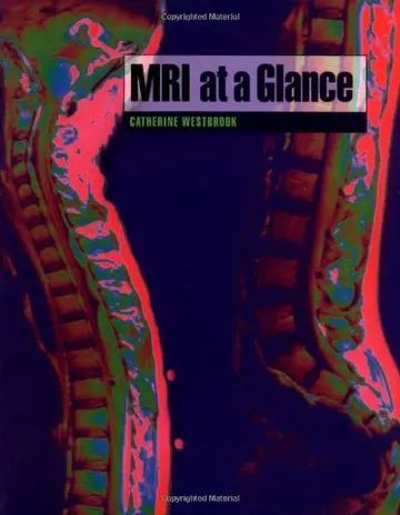 Cover of MRI at a Glance