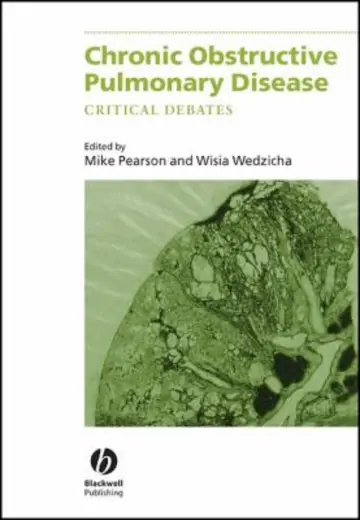 Cover of Chronic Obstructive Pulmonary Disease