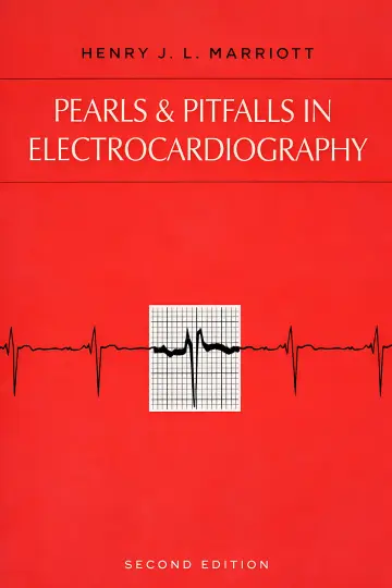 Cover of Pearls & Pitfalls in Electrocardiography