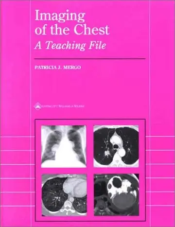 Cover of Imaging of the Chest