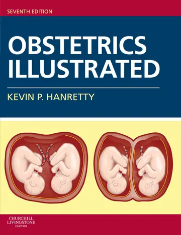 Cover of Obstetrics Illustrated 7Ed