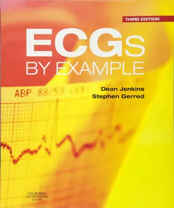 Cover of ECGs by Example