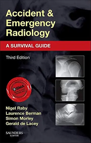 Cover of Accident and Emergency Radiology