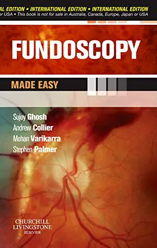 Cover of Fundoscopy Made Easy, International Edition