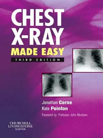 Cover of Chest X-Ray Made Easy