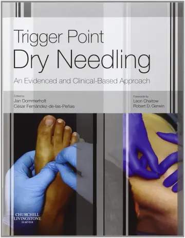 Cover of Trigger Point Dry Needling
