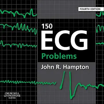 Cover of 150 ECG Problems