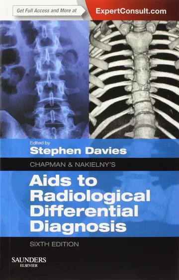 Cover of Chapman & Nakielny's Aids to Radiological Differential Diagnosis