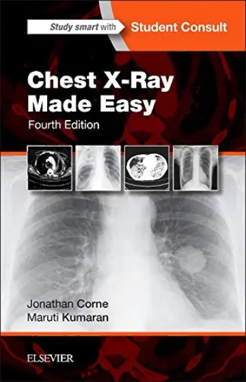 Cover of Chest X-Ray Made Easy