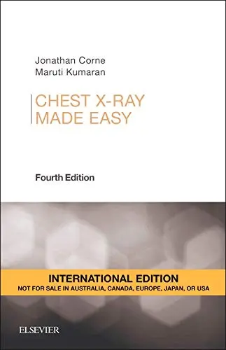Cover of Chest X-Ray Made Easy, International Edition