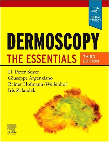 Cover of Dermoscopy