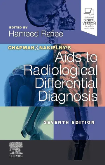 Cover of Chapman & Nakielny's Aids to Radiological Differential Diagnosis