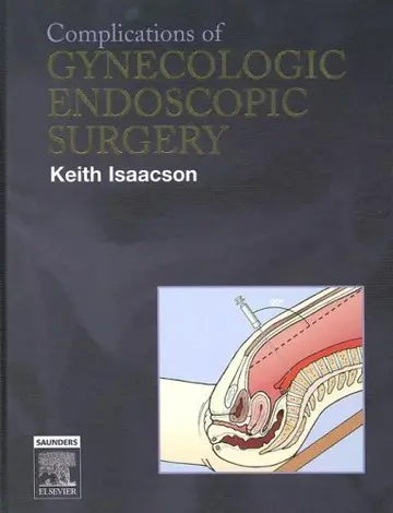 Cover of Complications of Gynecologic Endoscopic Surgery