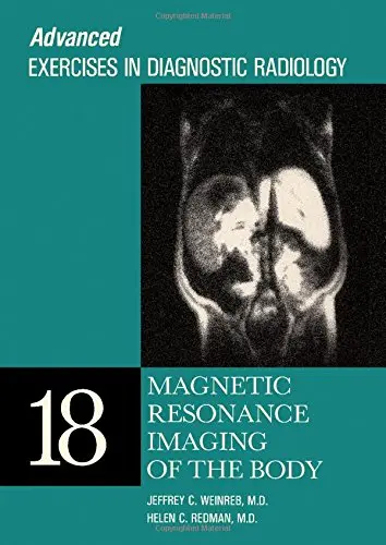 Cover of Magnetic Resonance Imaging