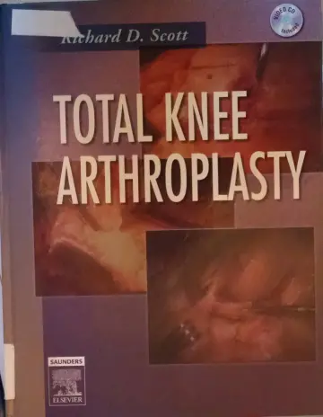 Cover of Total Knee Arthroplasty