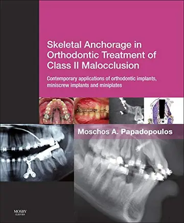 Cover of Skeletal Anchorage in Orthodontic Treatment of Class II Malocclusion