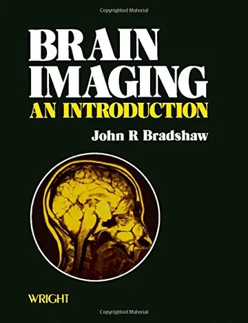 Cover of Brain Imaging