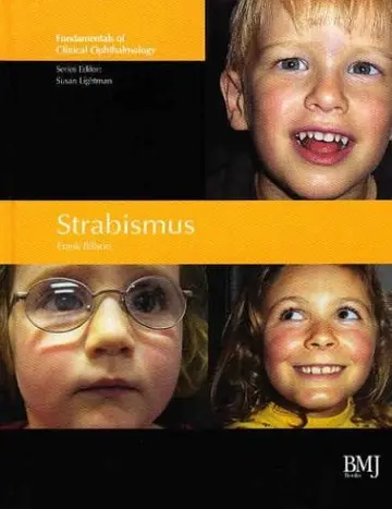 Cover of Strabismus