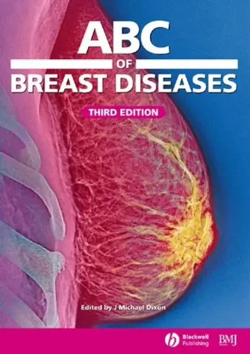 Cover of Abc of Breast Diseases