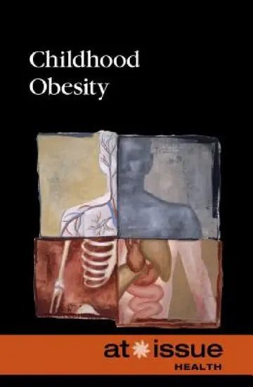 Cover of Childhood Obesity
