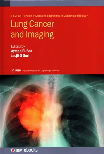 Cover of Lung Cancer and Imaging