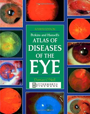 Cover of Perkins and Hansell's Atlas of Diseases of the Eye