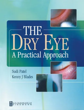 Cover of The Dry Eye
