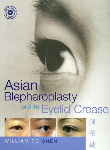 Cover of Asian Blepharoplasty and the Eyelid Crease