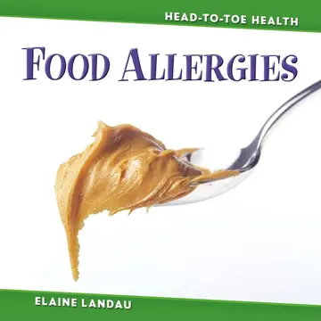 Cover of Food Allergies