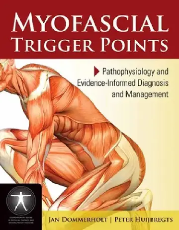 Cover of Myofascial Trigger Points