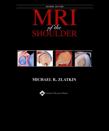 Cover of Mri of the Shoulder