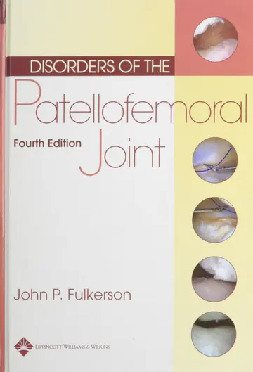 Cover of Disorders of the Patellofemoral Joint