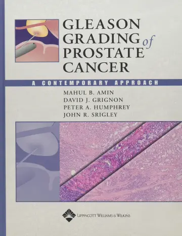 Cover of Gleason Grading of Prostate Cancer