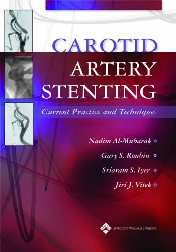 Cover of Carotid Artery Stenting