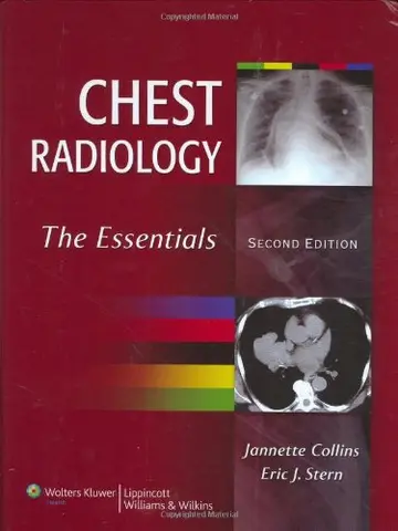 Cover of Chest Radiology