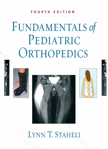 Cover of Foundamentals of Pediatric Orthopedics 4Ed