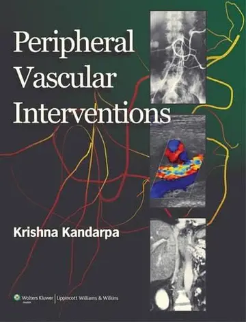 Cover of Peripheral Vascular Interventions