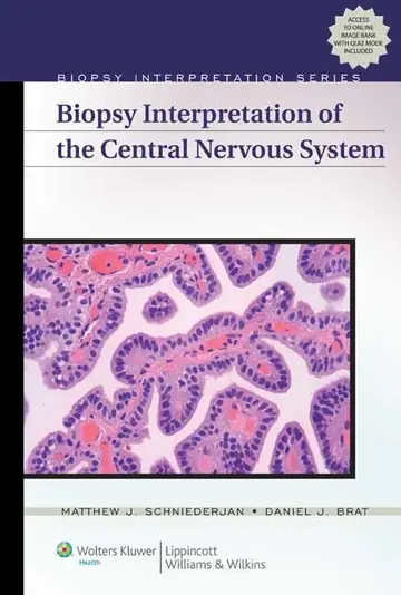 Cover of Biopsy Interpretation of the Central Nervous System