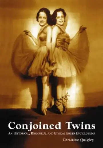 Cover of Conjoined Twins