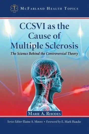 Cover of CCSVI as the Cause of Multiple Sclerosis