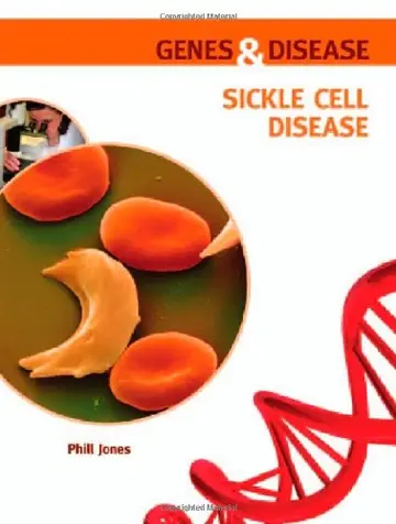Cover of Sickle Cell Disease