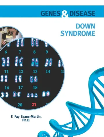 Cover of Down Syndrome