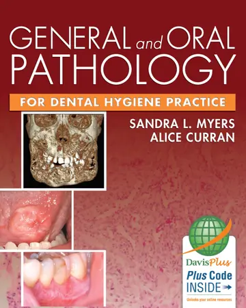 Cover of General and Oral Pathology for Dental Hygiene Practice