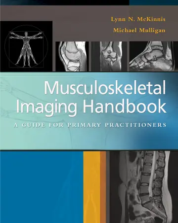 Cover of Musculoskeletal Imaging Handbook