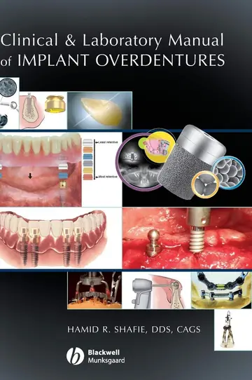 Cover of Clinical and Laboratory Manual of Implant Overdentures